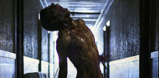 INFECCIÓN Infección